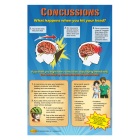 10-4887 Concussions: What Happens to Your Head Poster